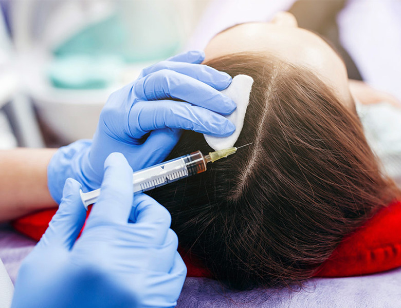 PRP Therapy and Laser Treatments